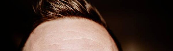 Исследователи обнаружили неожиданное лекарство от облысения
