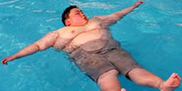 Ожирение провоцирует у азиатов рак