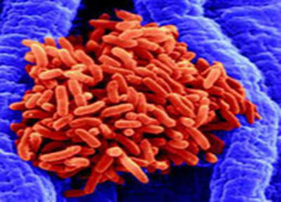 Ученые оживили древнюю бактерию
