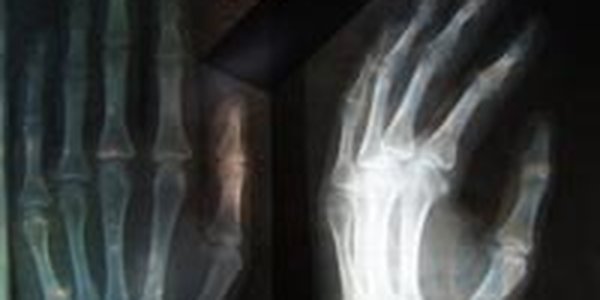 Больницы Владивостока скоро получат новое рентген-оборудование