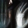 Больницы Владивостока скоро получат новое рентген-оборудование