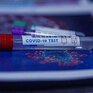 Экспресс-тесты на коронавирус появились в торговой сети Владивостока