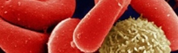 Глобальное потепление грозит сибирской язвой