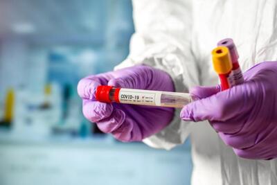 Роспотребнадзор: новых случаев заболевания коронавирусом в Приморье не выявлено