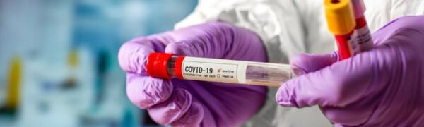 Роспотребнадзор: новых случаев заболевания коронавирусом в Приморье не выявлено